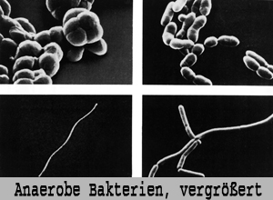 Anaerobe Bakterien